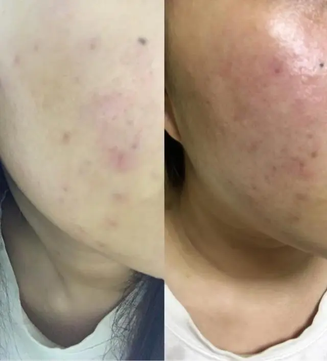 갈락토미 나이아신 에센스 50ml
