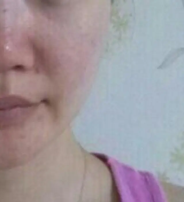 갈락토미 나이아신 에센스 50ml
