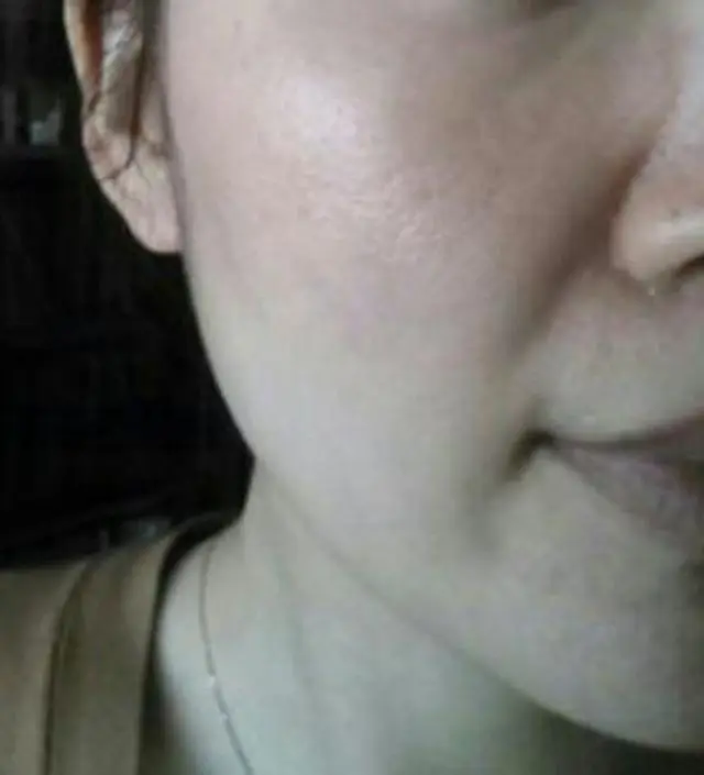 갈락토미 나이아신 에센스 50ml
