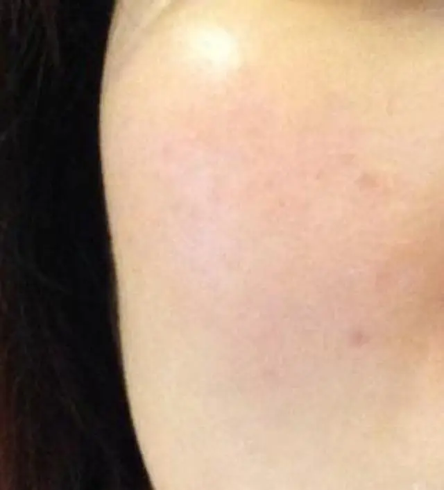 갈락토미 나이아신 에센스 50ml
