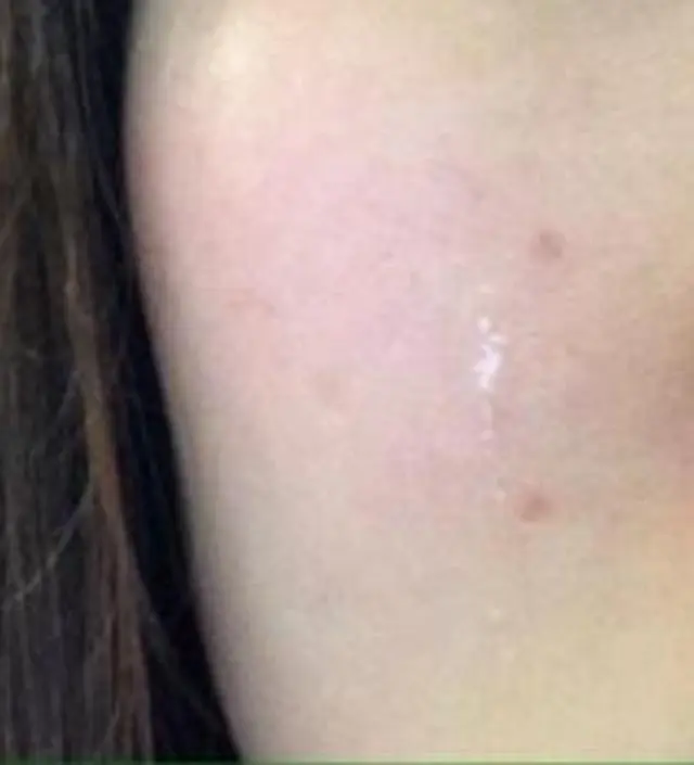 갈락토미 나이아신 에센스 50ml
