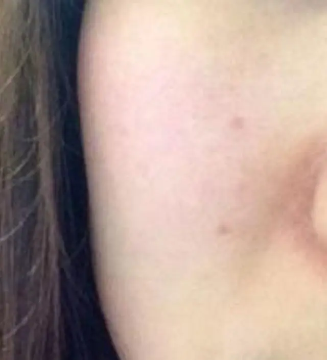 갈락토미 나이아신 에센스 50ml
