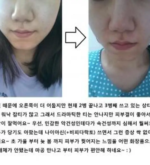 갈락토미 나이아신 에센스 50ml
