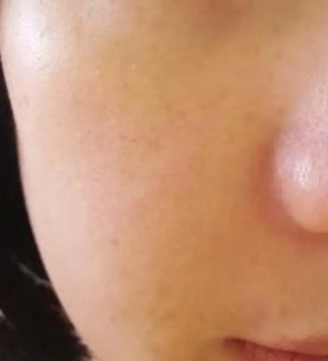 갈락토미 나이아신 에센스 50ml
