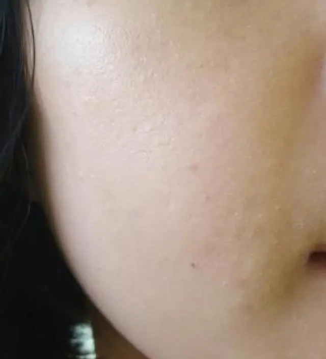 갈락토미 나이아신 에센스 50ml
