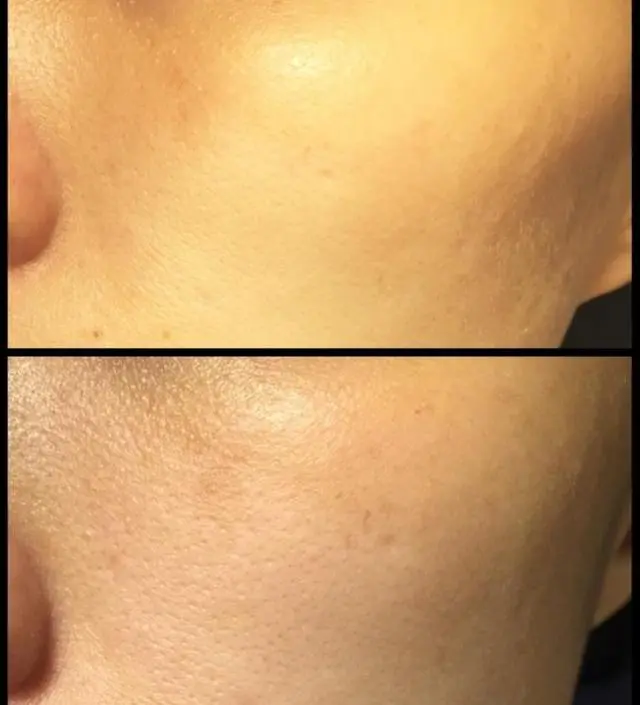 갈락토미 나이아신 에센스 50ml
