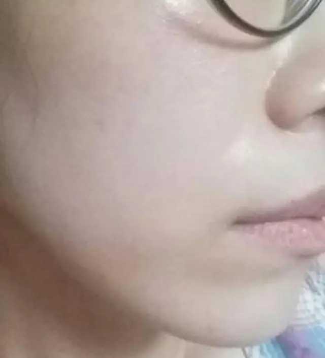 갈락토미 나이아신 에센스 50ml
