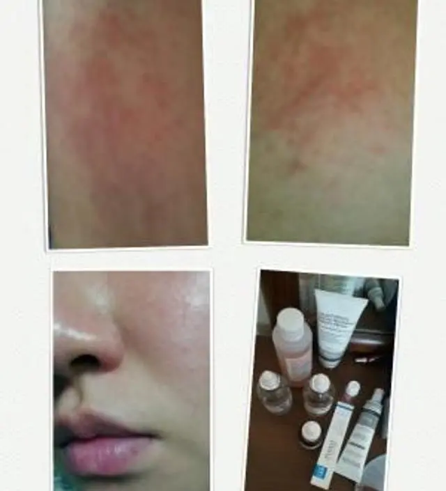 갈락토미 나이아신 에센스 50ml
