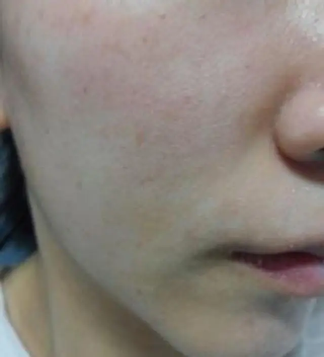 갈락토미 나이아신 에센스 50ml
