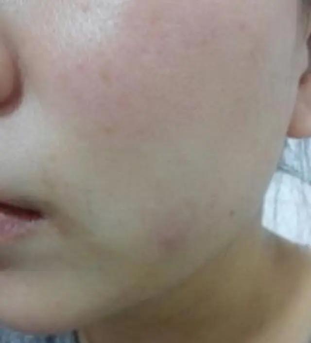 갈락토미 나이아신 에센스 50ml
