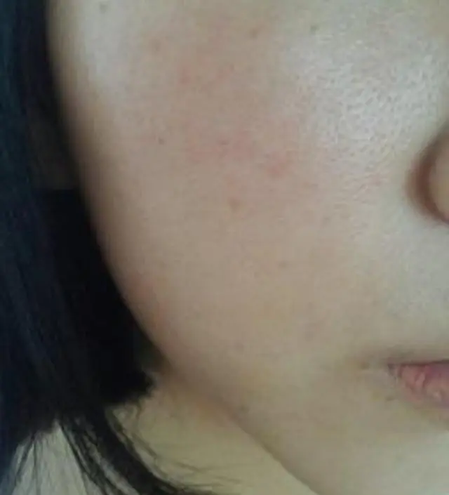 갈락토미 나이아신 에센스 50ml
