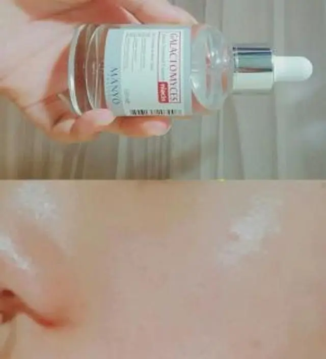 갈락토미 나이아신 에센스 50ml
