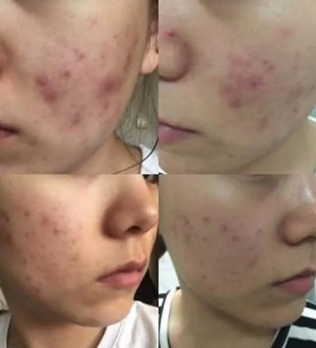 갈락토미 나이아신 에센스 50ml
