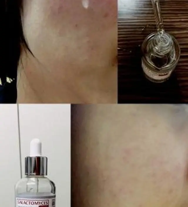 갈락토미 나이아신 에센스 50ml
