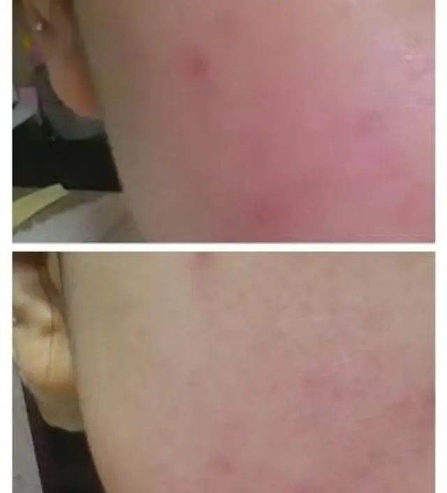 갈락토미 나이아신 에센스 50ml
