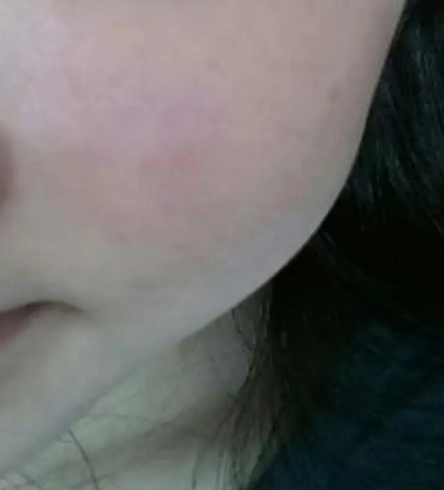 갈락토미 나이아신 에센스 50ml
