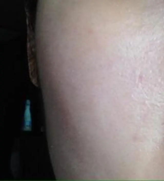 갈락토미 나이아신 에센스 50ml
