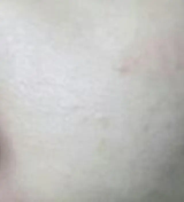 갈락토미 나이아신 에센스 50ml
