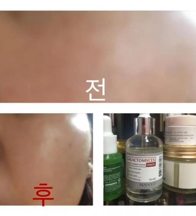 갈락토미 나이아신 에센스 50ml
