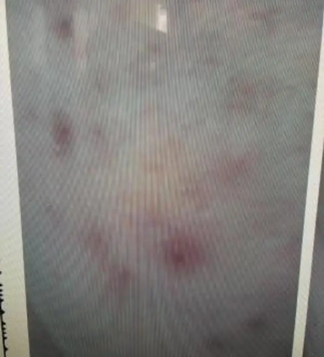 갈락토미 나이아신 에센스 50ml
