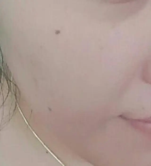 갈락토미 나이아신 에센스 50ml
