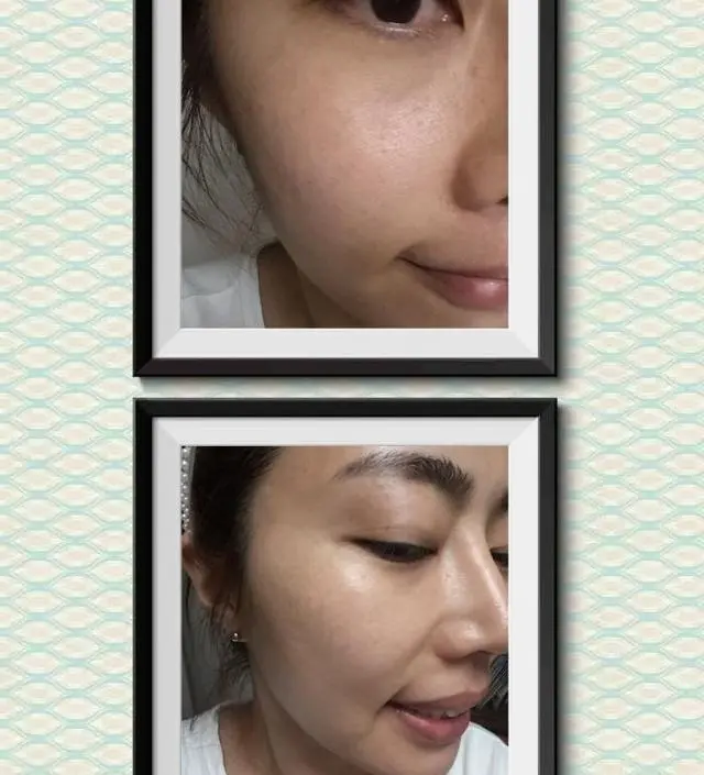 갈락토미 나이아신 에센스 50ml
