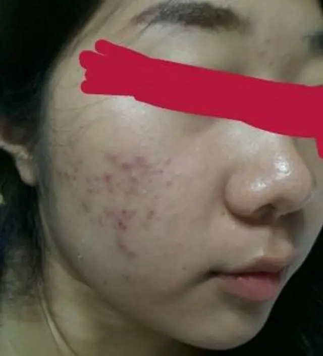 갈락토미 나이아신 에센스 50ml
