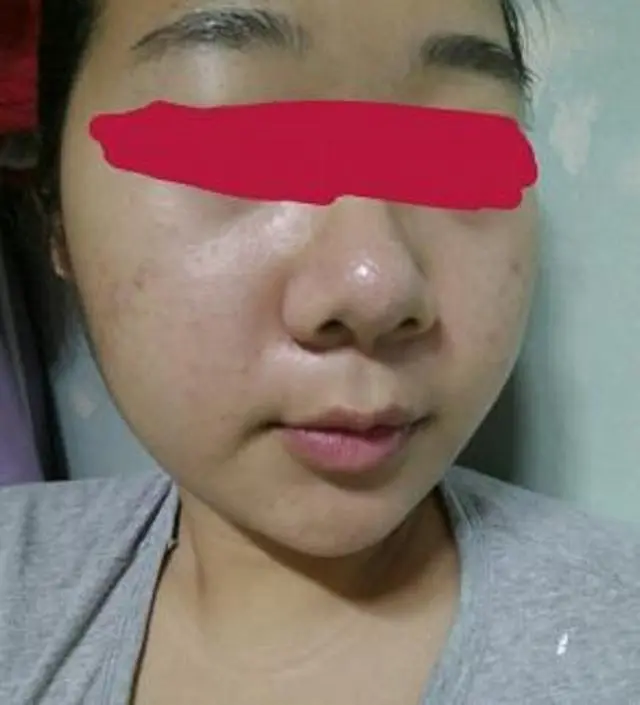 갈락토미 나이아신 에센스 50ml
