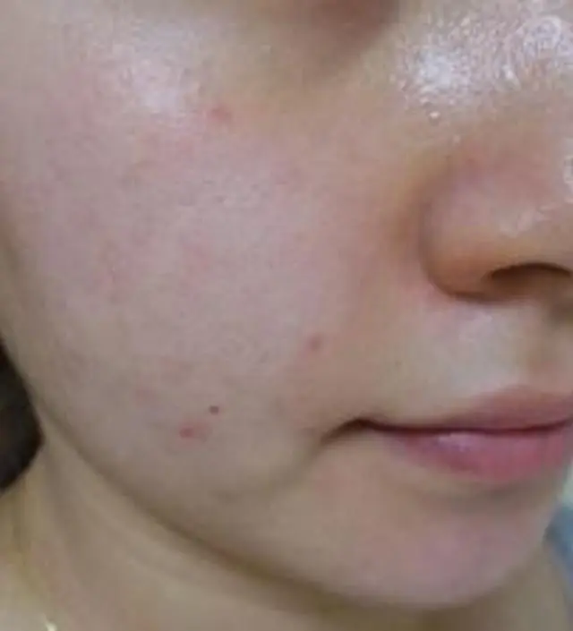 갈락토미 나이아신 에센스 50ml
