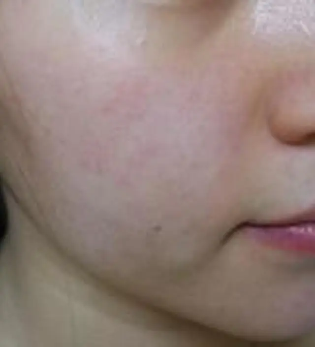 갈락토미 나이아신 에센스 50ml
