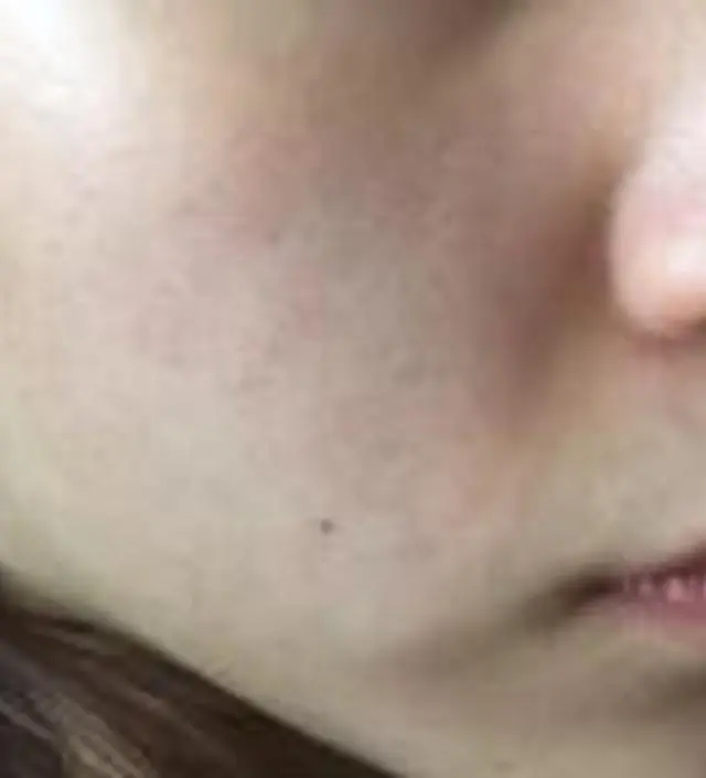 갈락토미 나이아신 에센스 50ml
