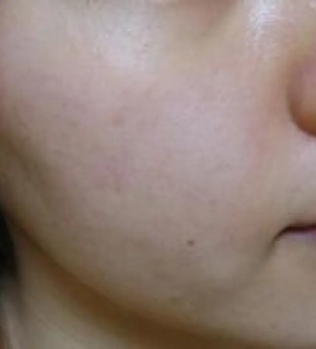 갈락토미 나이아신 에센스 50ml
