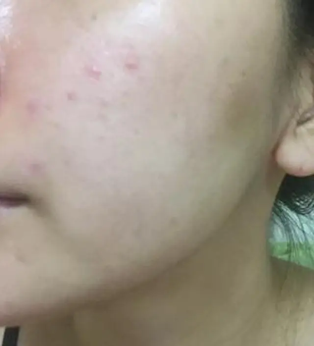 갈락토미 나이아신 에센스 50ml
