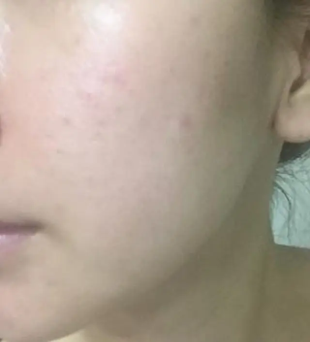 갈락토미 나이아신 에센스 50ml
