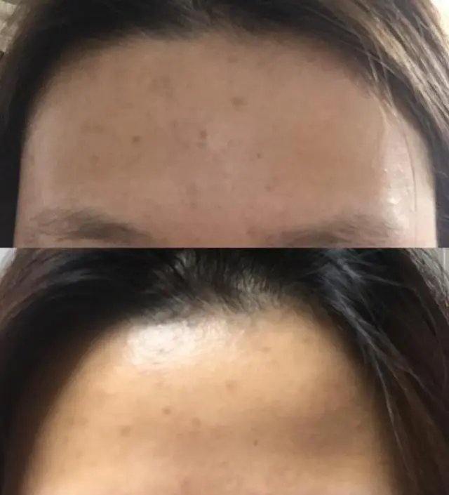 갈락토미 나이아신 에센스 50ml
