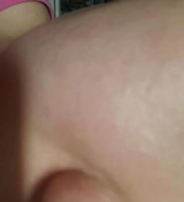 갈락토미 나이아신 에센스 50ml
