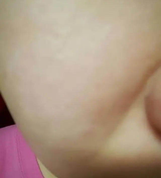 갈락토미 나이아신 에센스 50ml
