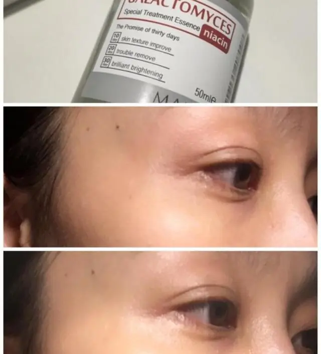 갈락토미 나이아신 에센스 50ml
