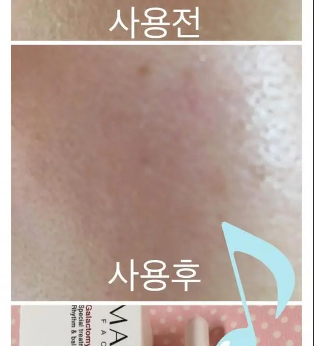 갈락토미 나이아신 에센스 50ml
