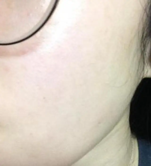 갈락토미 나이아신 에센스 50ml
