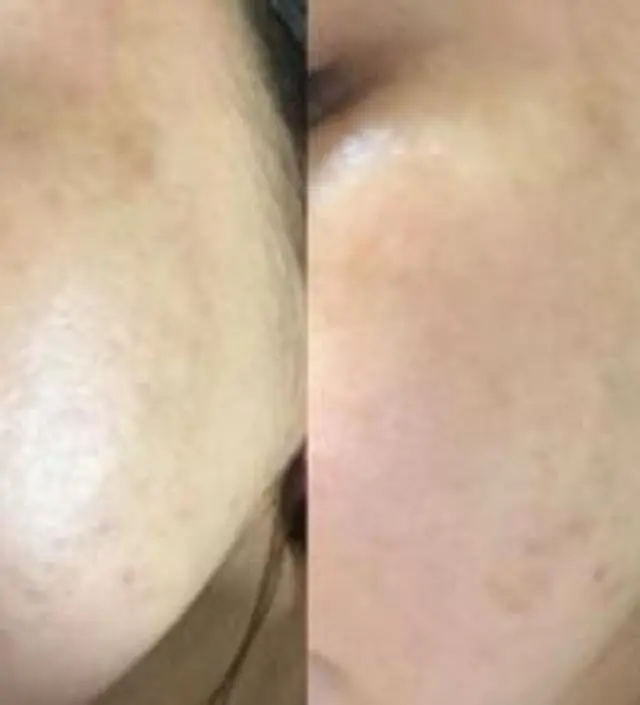 갈락토미 나이아신 에센스 50ml
