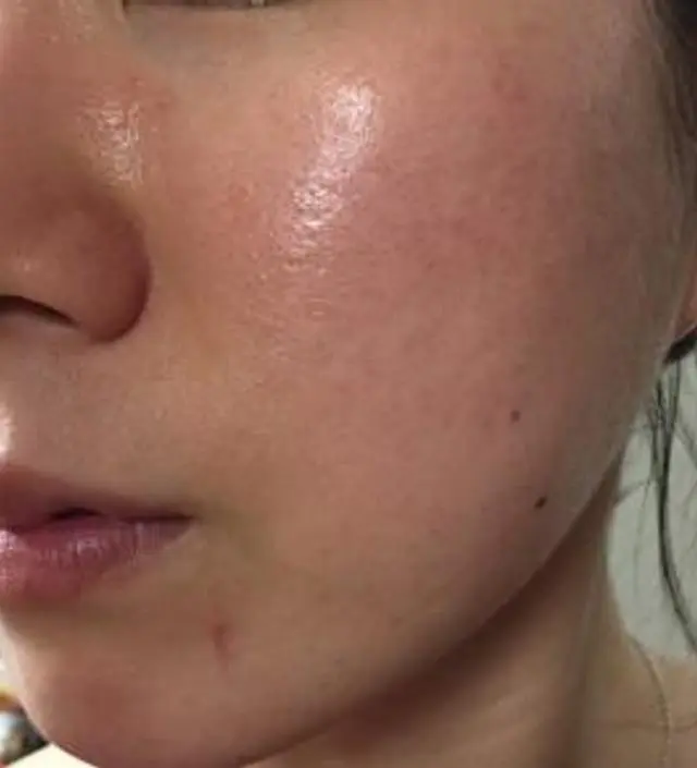 갈락토미 나이아신 에센스 50ml
