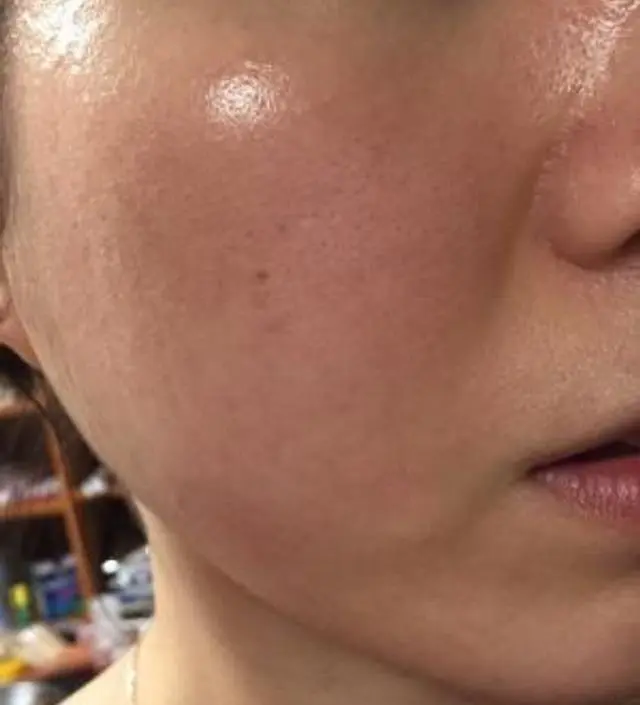 갈락토미 나이아신 에센스 50ml
