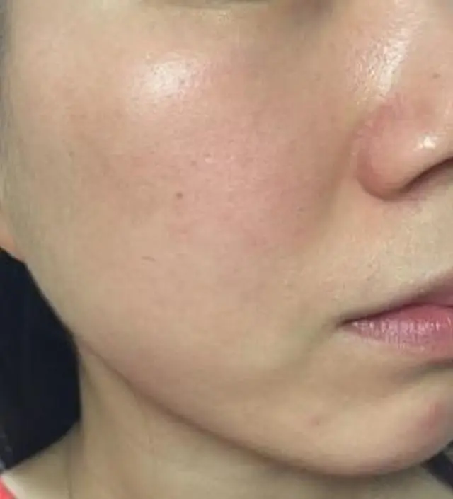 갈락토미 나이아신 에센스 50ml
