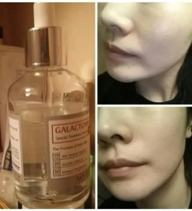 갈락토미 나이아신 에센스 50ml
