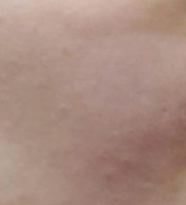 갈락토미 나이아신 에센스 50ml
