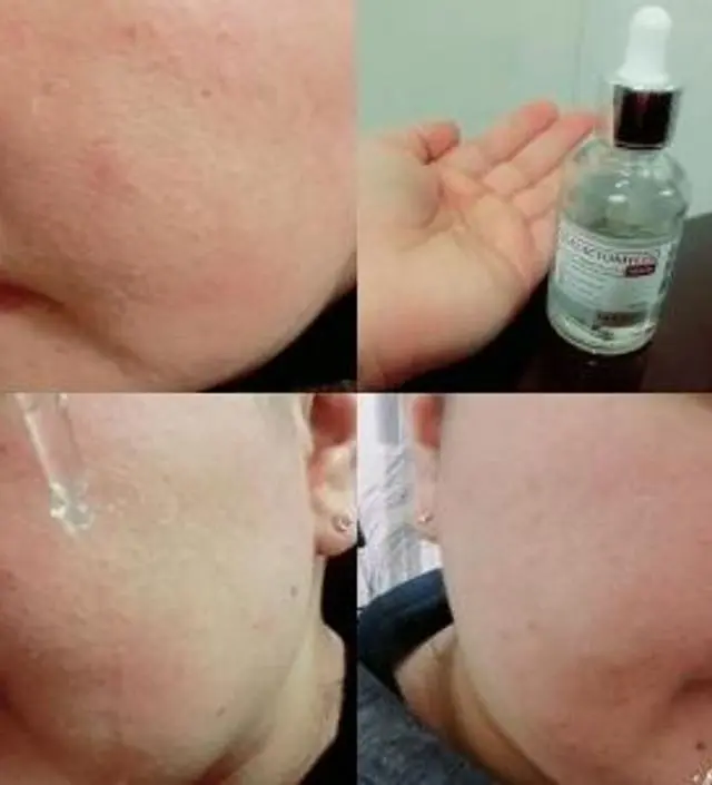 갈락토미 나이아신 에센스 50ml
