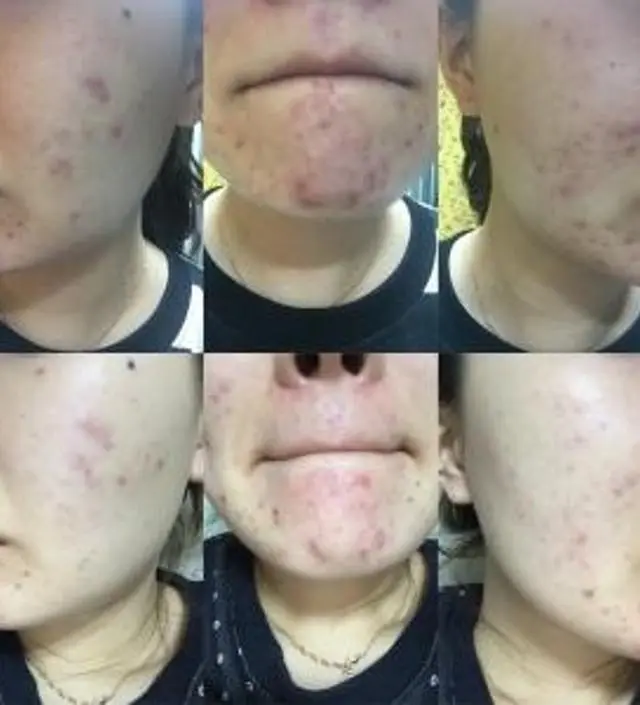 갈락토미 나이아신 에센스 50ml
