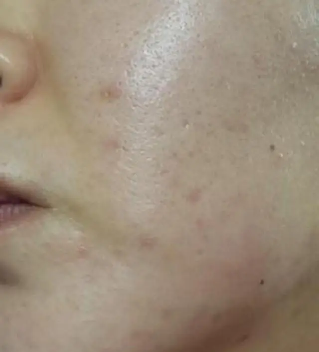 갈락토미 나이아신 에센스 50ml
