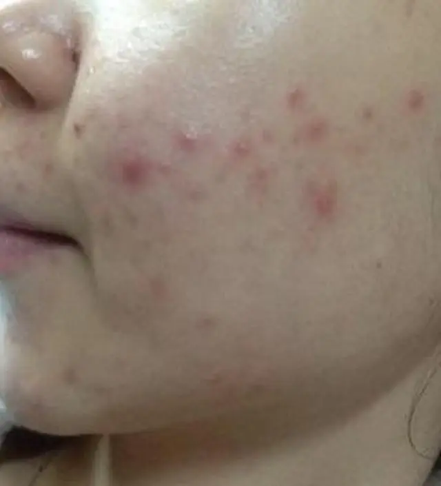 갈락토미 나이아신 에센스 50ml
